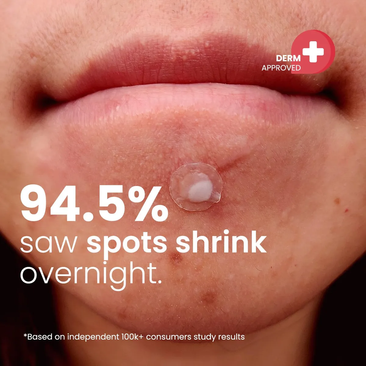 ROSELYNBOUTIQUE Pimple Patches for Face 300 Counts 4 Sizes Hydrocolloid Acne Patches with Tea Tree Oil