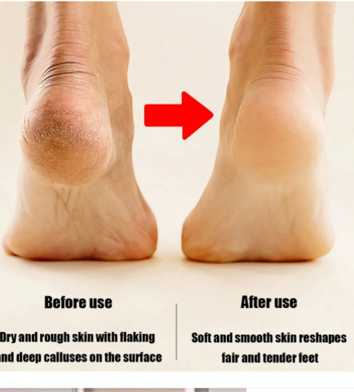 Electric Callus Remover, Professional Electric Corn Remover, Rechargeable Portable Electric Foot File Tool, Electric Callus Remover Kit - Ideal Gift For Smooth, Soft Feet - Hard, Cracked And Dry Skin Care