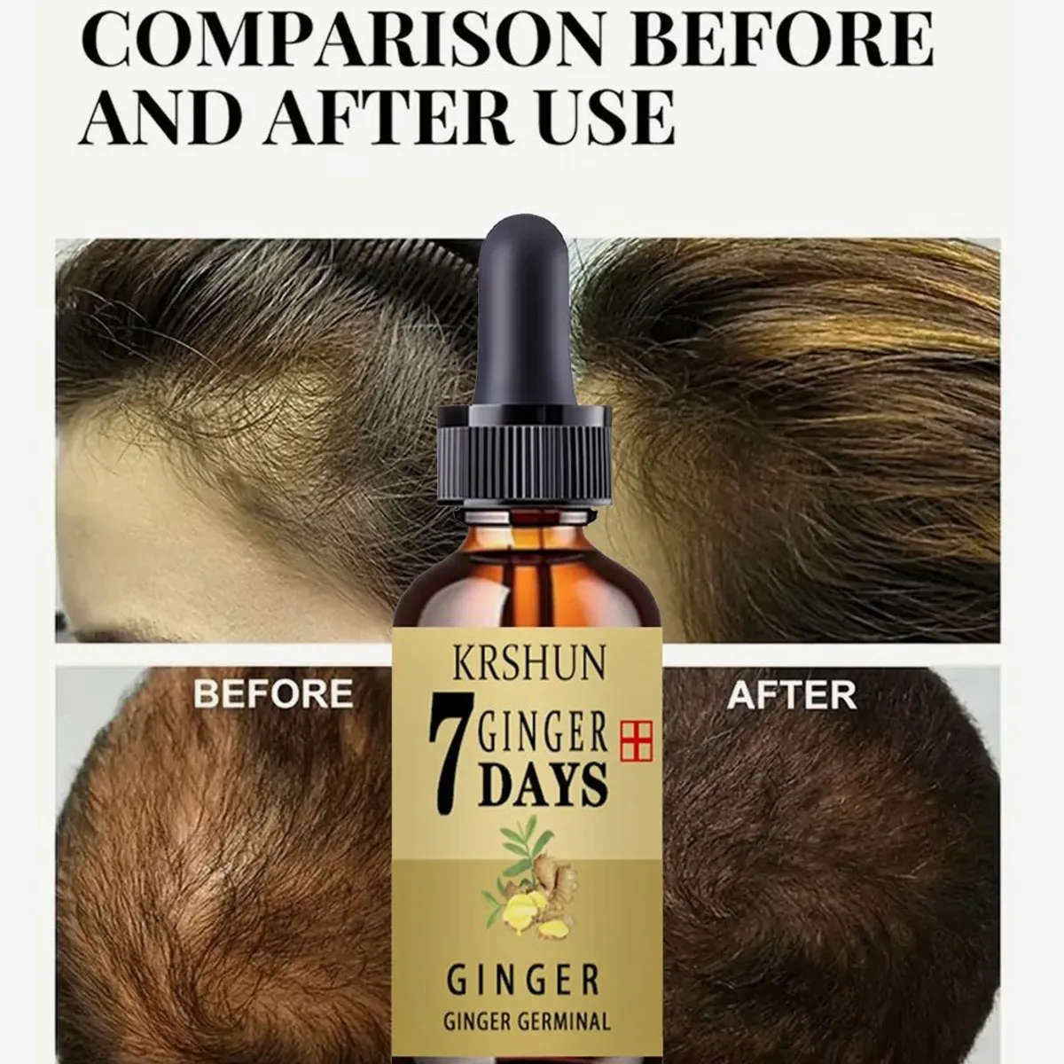 Ginger Hair Loss Treatment Organic Essential Oil