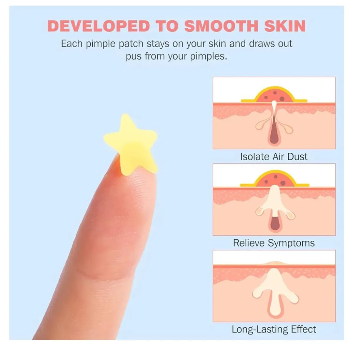 Hiloes Pimple Patches For The face 260 Pieces hydro-colloid Acne Patches To Cover Pimples And Blemishes