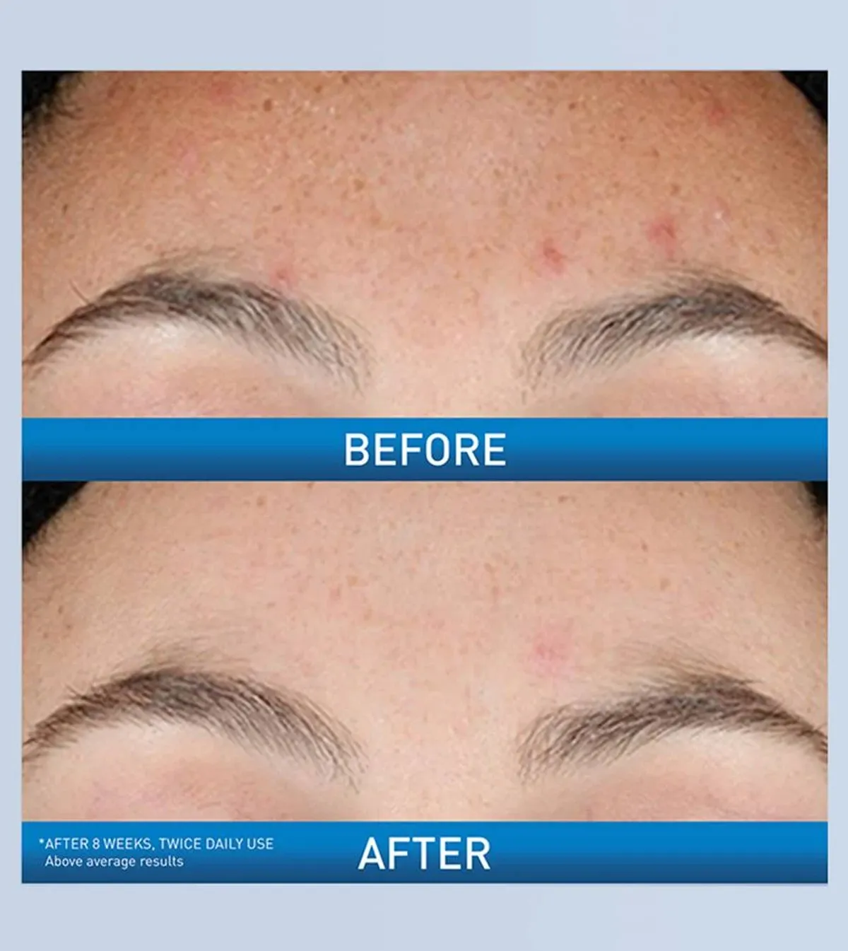Resurfacing Retinol Serum