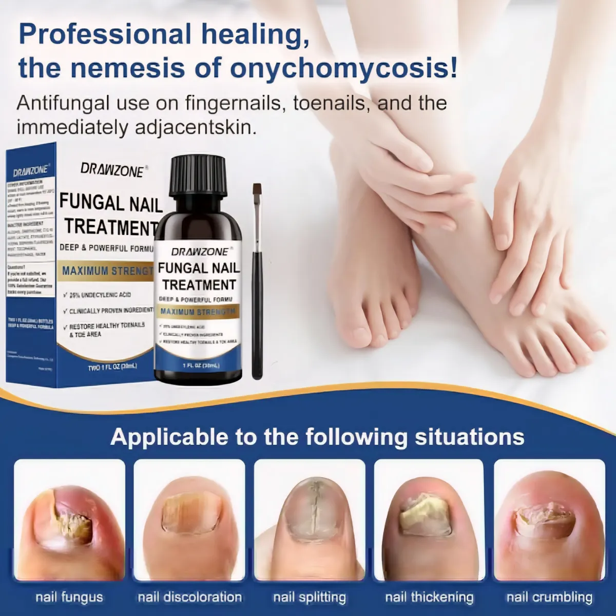 Drawzone Fungal Nail Treatment, Extra Strength with 25% Undecylenic Acid, Ingrown toenail treatment, 1 oz