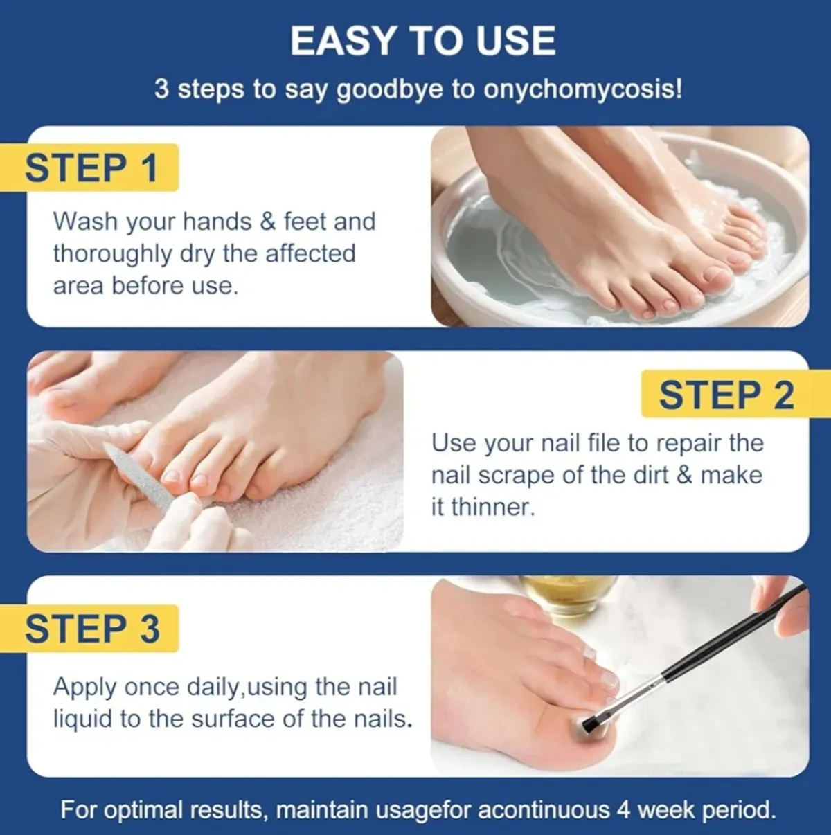 Drawzone Fungal Nail Treatment, Extra Strength with 25% Undecylenic Acid, Ingrown toenail treatment, 1 oz