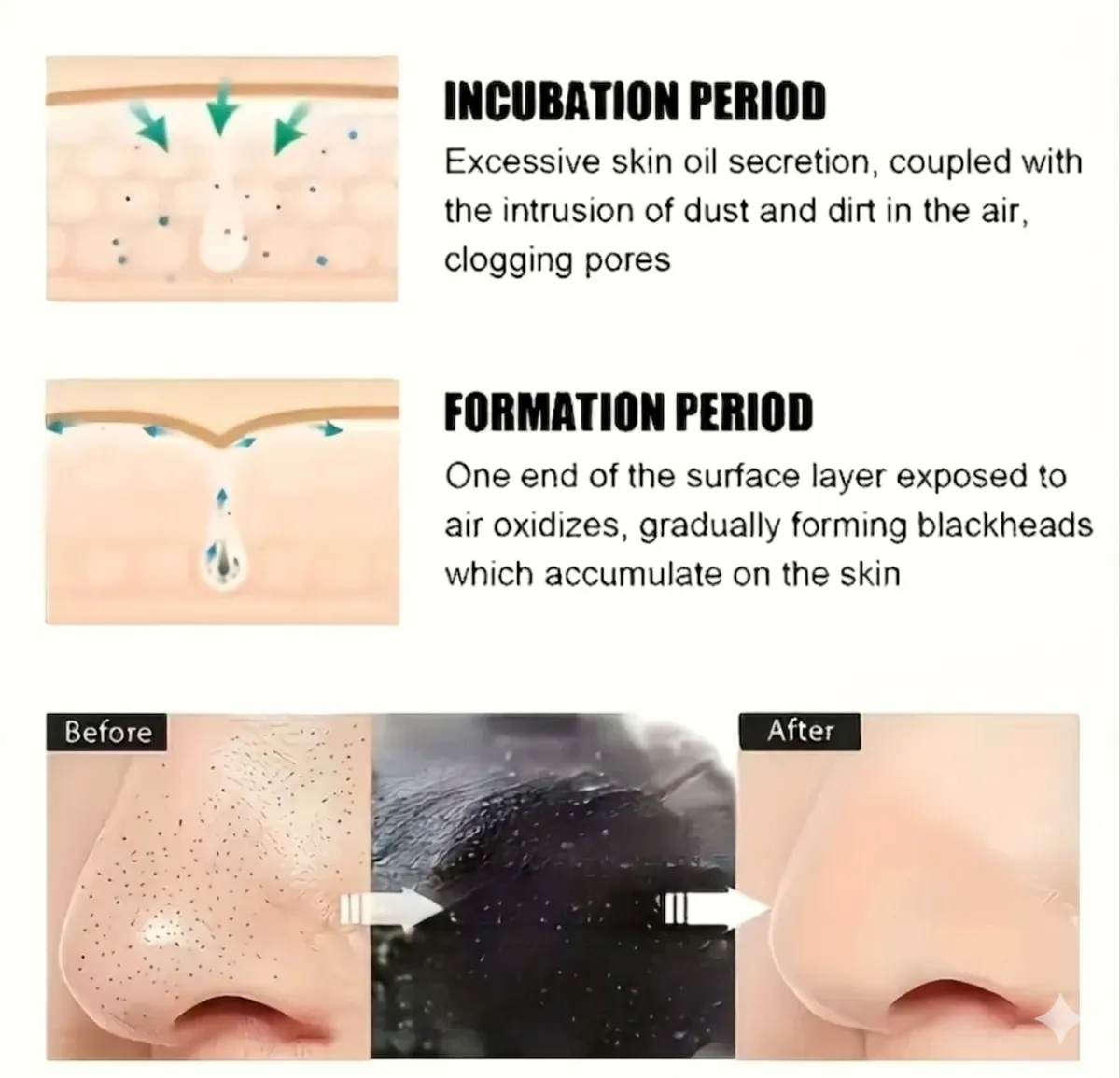 5 PCS Of Portable Single-Pack Black Nose Patch. Gently Cleanses Nasal Area, Helps Absorb Pore Dirt, Improves Greasy Feel, Contours Nose Shape, Convenient to Use. Skin Feels Fresh And Smooth After Use, Suitable for Daily Care of Oily And Combination Skin