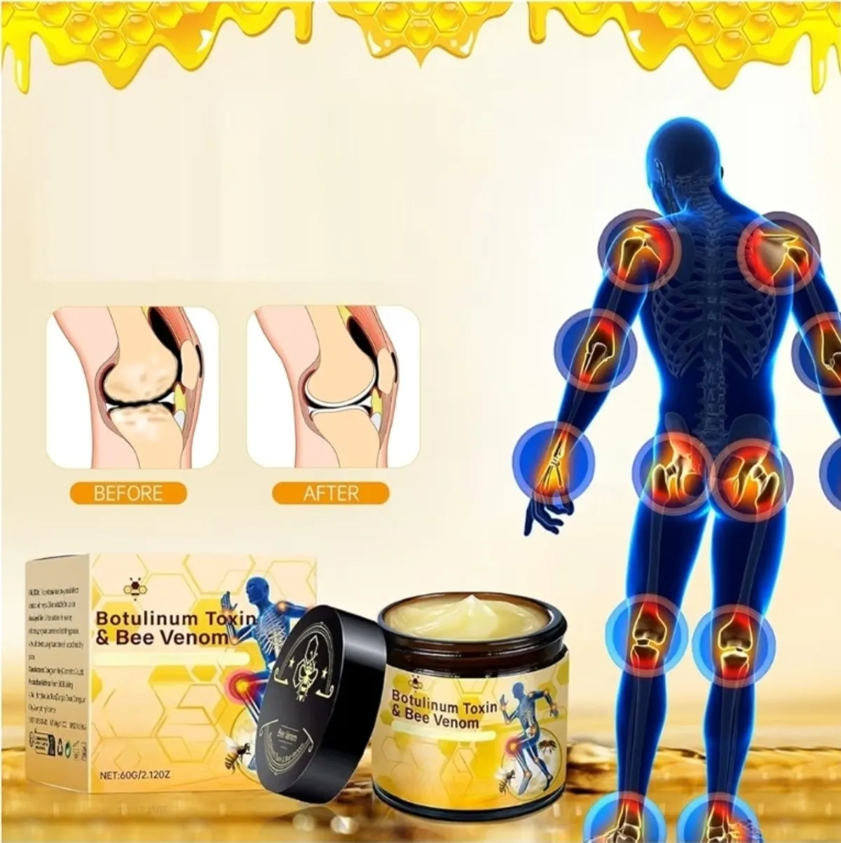 Botulinum Toxin & Bee Venom Joint Bone Healing Cream