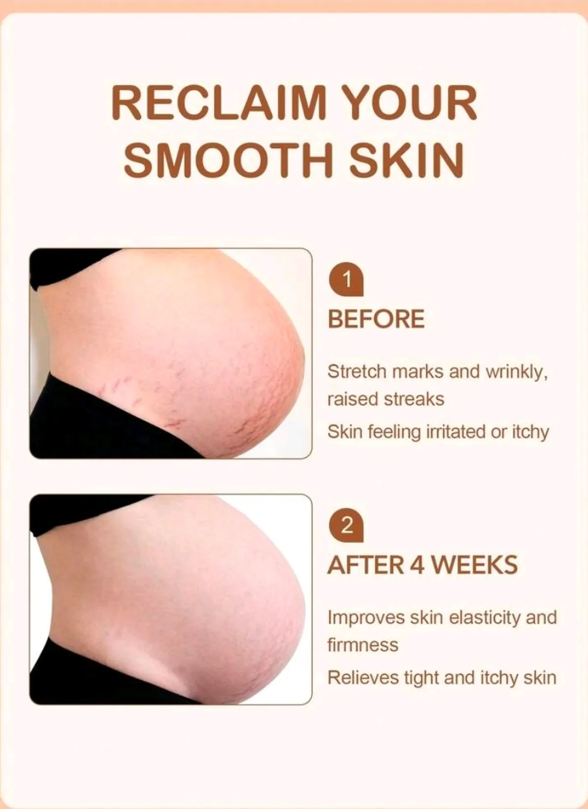 Slow Sunday Vitamin E Stretch Mark Cream