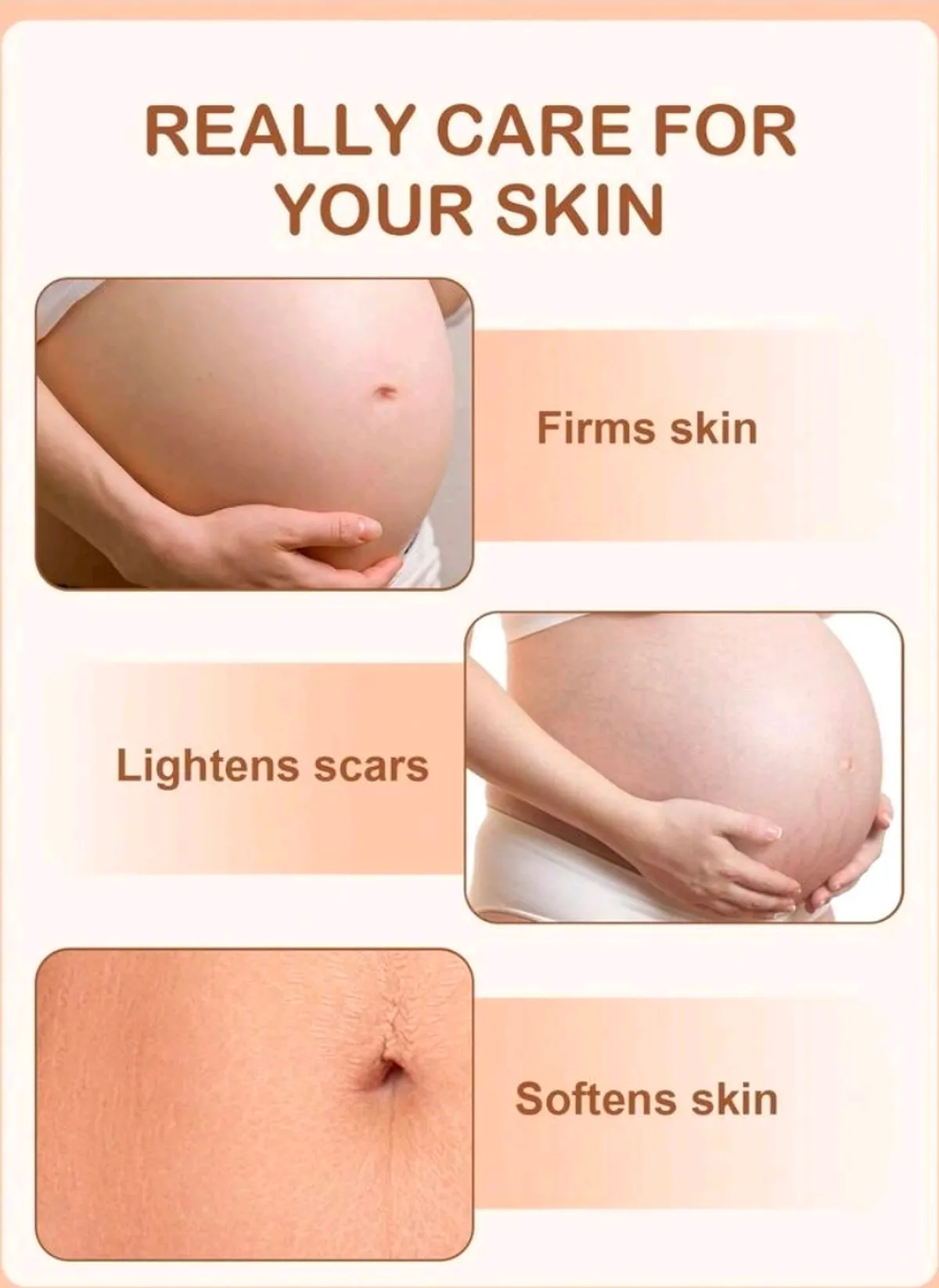 Slow Sunday Vitamin E Stretch Mark Cream