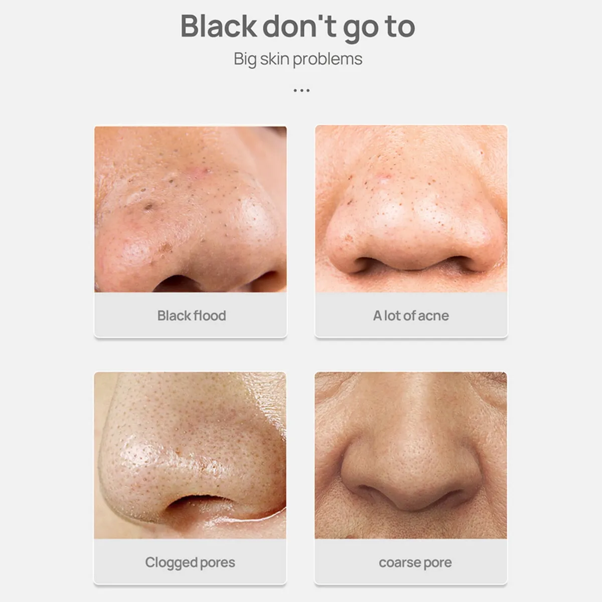 LANBENA Blackhead Removing Mask with 60pcs