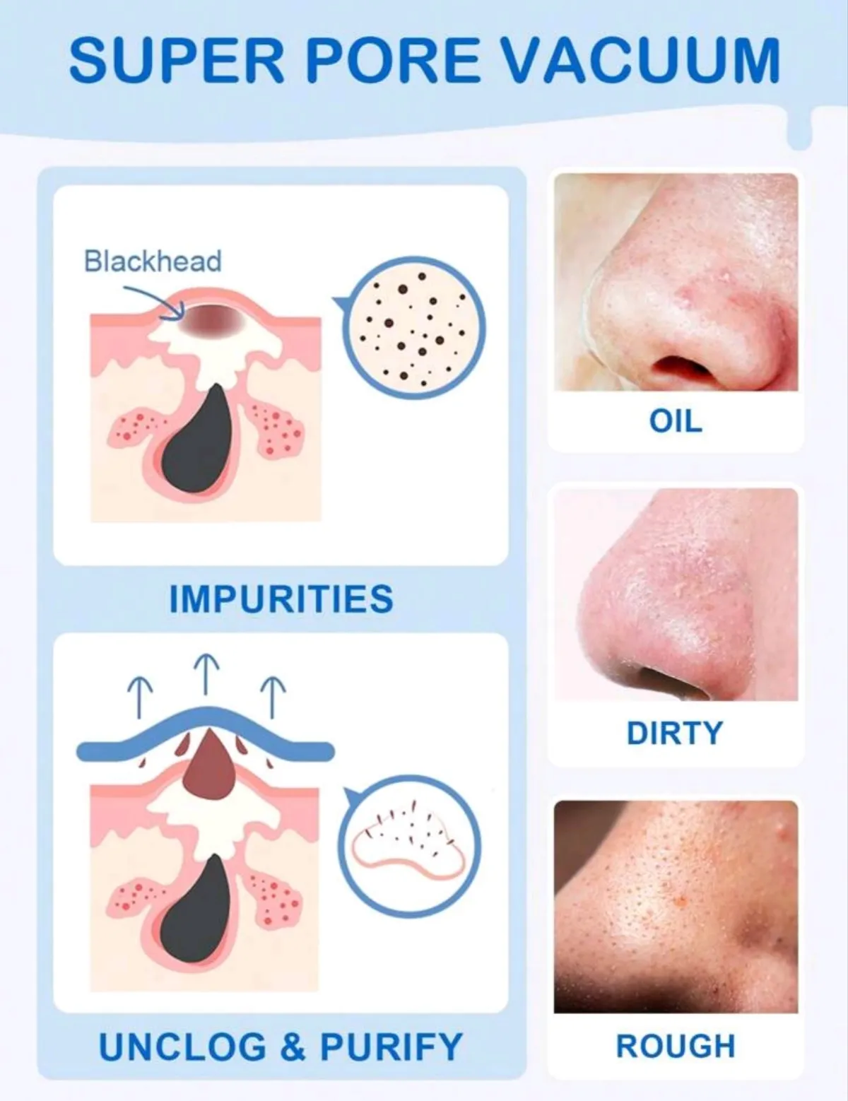 SlowSunday Blackhead Remover Nose Strips, 10PCS , Deep Cleanse And Refresh Your Skin, For Blackhead Removal On Oily Skin, With Instant Pore Unclogging, Features Natural Charcoal