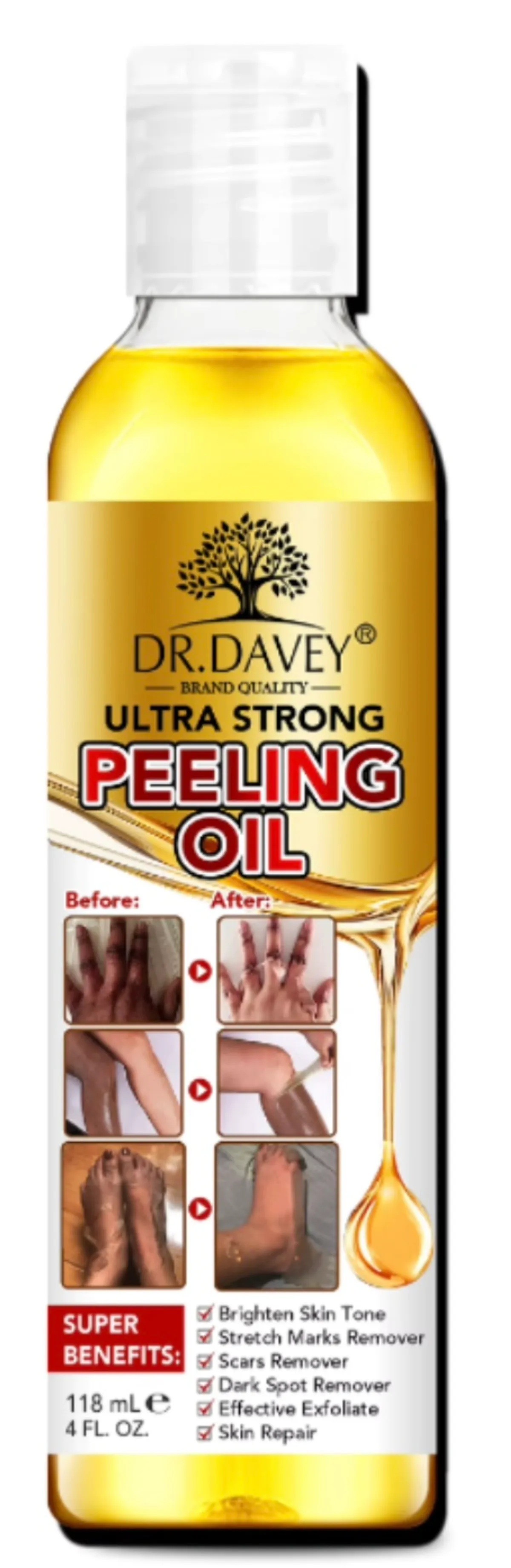 Dr. Davey Ultra Strong Peeling Oil for Dark Spots,Hyperpigmentation,Skin Brightening. 4 oz- 2 Units.