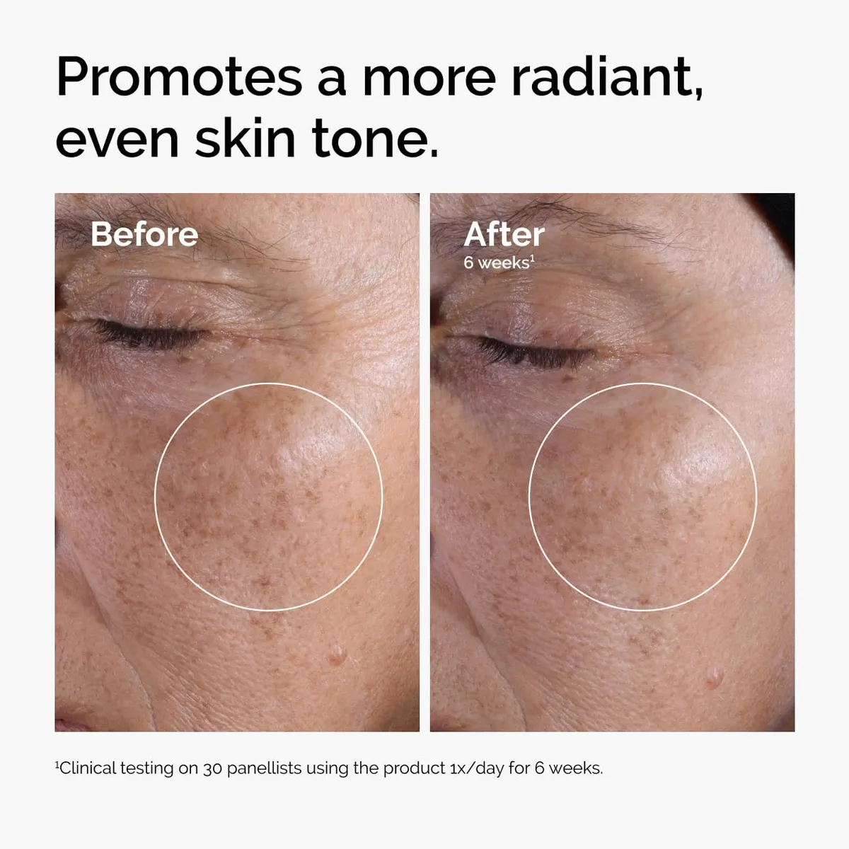 The Ordinary Glycolic Acid 7% Toning Solution, 3.4oz Exfoliating Face & Body Toner, Brightening Serum for Dark Spots, Acne Scars, Smooth Skin, Evening Skincare