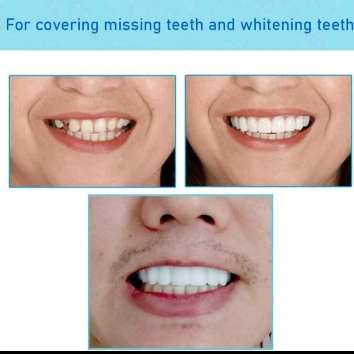 Silicone Cosmetic Smile Veneers Temporary Decorative Fake Teeth
