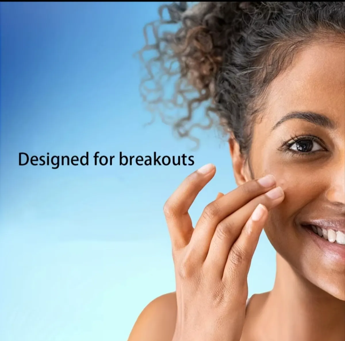 360 PCS Of Acne Patches With Salicylic Acid, Patches
